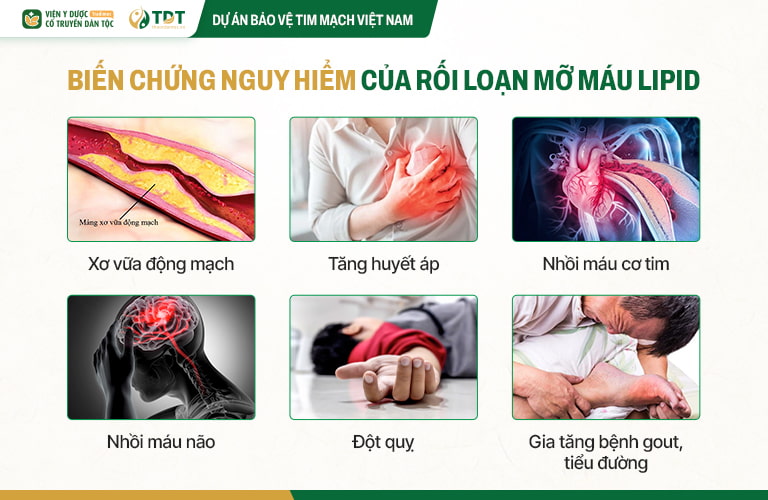 Rối loạn mỡ máu gây ra nhiều biến chứng vô cùng nguy hiểm, không thể xem nhẹ